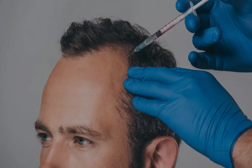 Mesotherapy for hair regrowth