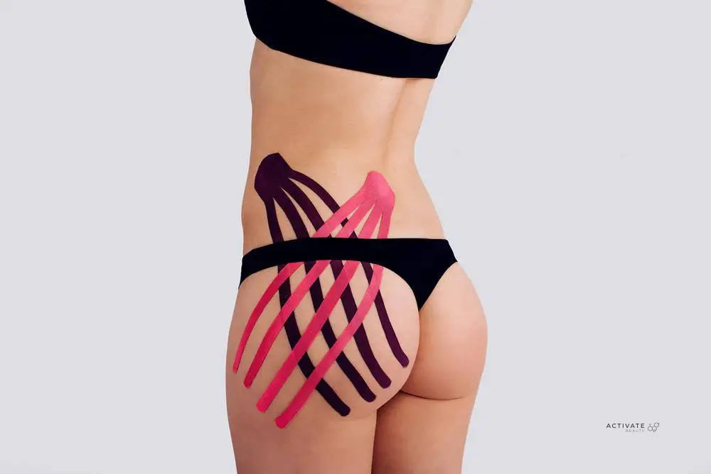 Kinesiotaping For Treatment Of Cellulite And Lymph Drainage Procedurs