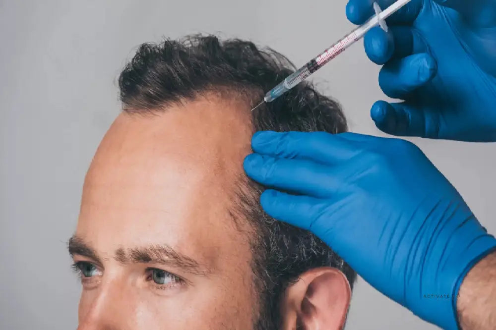 Mesotherapy For Hair Regrowth Procedurs