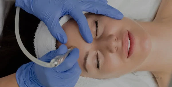 Microdermabrasion with Deep European Facial finished with Gloss almond peel
