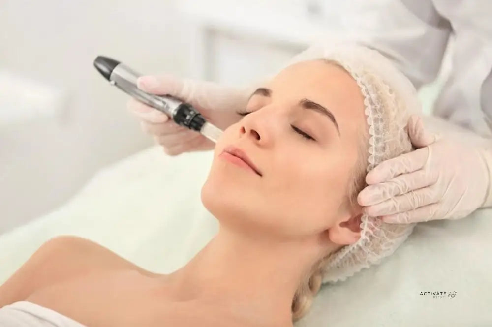 Microneedling With Exosomes / Mesococktail Procedurs