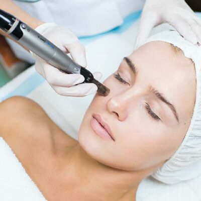 Microneedling with Infusion of Mesotherapy cocktails 1 session